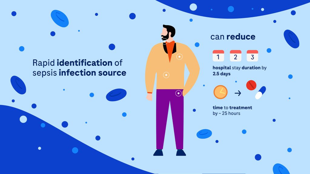 006_Diseaset_Video_Eml_Rome Sepsis infection source identification animation
